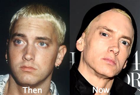 Did Eminem Have Plastic Surgery? Exploring the Rumors and Realities